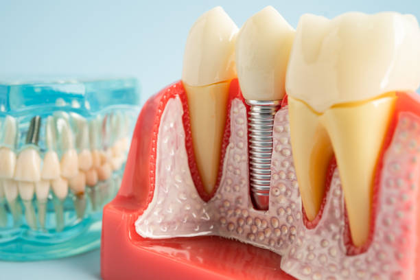 Best General Dentistry  in Chapman, KS